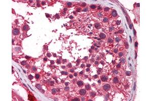 Anti-TERF2IP antibody IHC of human testis.