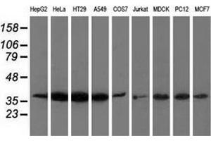 Western blot analysis of extracts (35 µg) from 9 different cell lines by using anti-ANXA3 monoclonal antibody. (Annexin A3 anticorps)