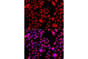 Immunofluorescence analysis of A549 cells using RAC3 antibody (ABIN5975576). (RAC3 anticorps)
