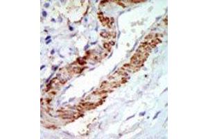 Image no. 1 for anti-Mitogen-Activated Protein Kinase Kinase Kinase 8 (MAP3K8) (C-Term) antibody (ABIN360298)