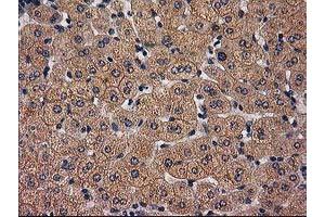 Image no. 3 for anti-Tubulin Folding Cofactor E-Like (TBCEL) antibody (ABIN1501326)