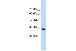 WB Suggested Anti-ADAMTS4 Antibody Titration:  0.