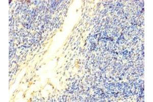 Immunohistochemistry of paraffin-embedded human thymus tissue using ABIN7150213 at dilution of 1:100 (TdT anticorps  (AA 1-509))