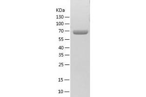 Western Blotting (WB) image for T-Complex 1 (TCP1) (AA 1-576) protein (His-IF2DI Tag) (ABIN7125306)