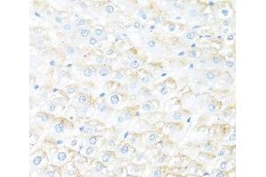 Immunohistochemistry of paraffin-embedded Rat liver using IL7 Polyclonal Antibody at dilution of 1:100 (40x lens). (IL-7 anticorps)
