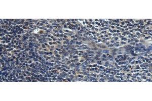Immunohistochemistry of paraffin-embedded Human tonsil tissue using HAUS6 Polyclonal Antibody at dilution of 1:45(x200) (FAM29A anticorps)