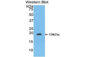 Western Blotting (WB) image for anti-Heat Shock Protein, alpha-Crystallin-Related, B6 (HSPB6) (AA 1-162) antibody (ABIN5661998) (HSPB6 anticorps  (AA 1-162))