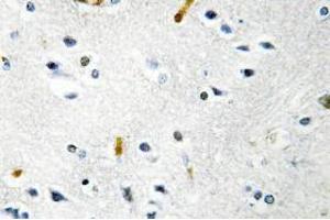 Image no. 1 for anti-TPX2, Microtubule-Associated, Homolog (Xenopus Laevis) (TPX2) antibody (ABIN317807) (TPX2 anticorps)