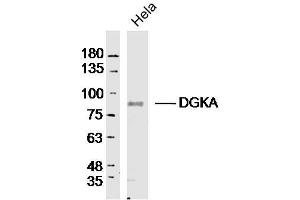 Hela lysates probed with DGKA Polyclonal Antibody, Unconjugated  at 1:300 dilution and 4˚C overnight incubation. (DGKA anticorps  (AA 201-300))