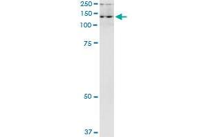 Immunoprecipitation of ADAR transfected lysate using anti-ADAR MaxPab rabbit polyclonal antibody and Protein A Magnetic Bead , and immunoblotted with ADAR purified MaxPab mouse polyclonal antibody (B01P) .
