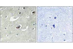 Immunohistochemistry (IHC) image for anti-Kinesin Family Member 20A (KIF20A) (AA 501-550) antibody (ABIN2888893) (KIF20A anticorps  (AA 501-550))