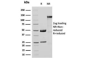 SDS-PAGE Analysis Purified MTAP Recombinant Rabbit Monoclonal Antibody (MTAP/3137R).