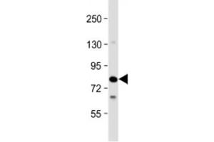 Western blot testing of human Jurkat cell lysate with SLP76 antibody at 1:2000.