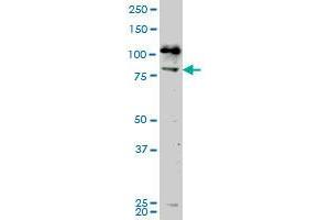 Western Blotting (WB) image for anti-NIMA-Related Kinase 5 (NEK5) (AA 601-709) antibody (ABIN961565) (NEK5 anticorps  (AA 601-709))