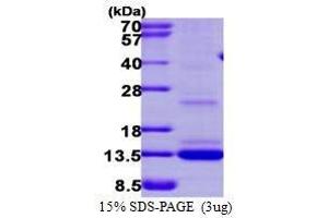 Figure annotation denotes ug of protein loaded and % gel used. (Matrix Gla Protein (MGP) (AA 20-96) peptide (His tag))
