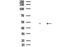 anti-Synovial Sarcoma Translocation, Chromosome 18 (SS18) (N-Term) antibody