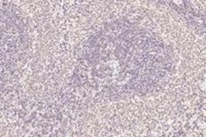 Immunohistochemistry analysis of paraffin-embedded rat spleen using,APRIL (ABIN7072887) at dilution of 1: 1200