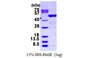 Image no. 1 for rho GDP Dissociation Inhibitor (GDI) beta (ARHGDIB) protein (GST tag) (ABIN1098209) (ARHGDIB Protein (GST tag))