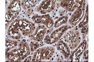 Image no. 7 for anti-Rhotekin (RTKN) antibody (ABIN1500702) (Rhotekin anticorps)