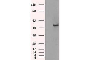 Image no. 1 for anti-Solute Carrier Family 2 (Facilitated Glucose/fructose Transporter), Member 5 (SLC2A5) antibody (ABIN1498473) (SLC2A5 anticorps)