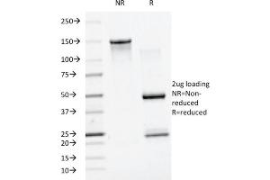 SDS-PAGE Analysis Purified SUMO-1 Mouse Monoclonal Antibody (SM1/495). (SUMO1 anticorps)