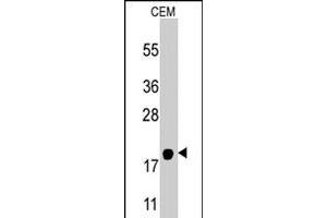 Western blot analysis of PPBP polyclonal antibody  in CEM cell line lysates (35 ug/lane). (CXCL7 anticorps  (AA 99-128))