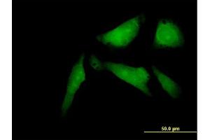 Immunofluorescence of purified MaxPab antibody to SSX2IP on HeLa cell.