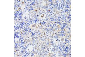 Immunohistochemistry of paraffin-embedded mouse spleen using MLF2 antibody (ABIN7268725) at dilution of 1:100 (40x lens). (MLF2 anticorps  (AA 1-65))