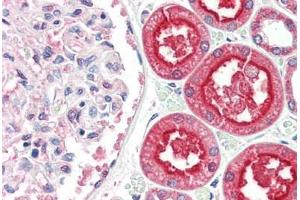 Human Kidney (formalin-fixed, paraffin-embedded) stained with ACE2 antibody ABIN461888 at 2. (ACE2 anticorps  (Internal Region))