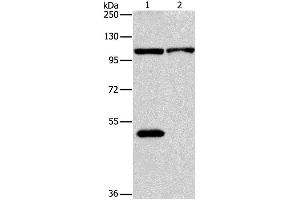Western Blotting (WB) image for anti-NLR Family, Pyrin Domain Containing 3 (NLRP3) antibody (ABIN2427660) (NLRP3 anticorps)