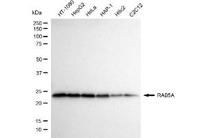 Western blotting analysis using RAB5A antibody (ABIN7800098).