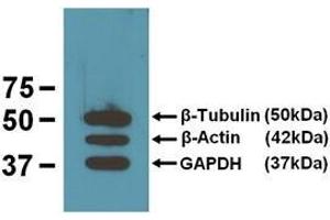 EBI’s three loading control mAbs reacting against 10μg/lane of mouse brain tissue lysates.