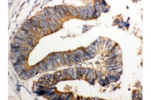 IHC(P): Human Intestinal Tissue (NMI anticorps  (AA 2-307))