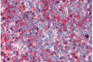 Human Spleen: Formalin-Fixed, Paraffin-Embedded (FFPE)