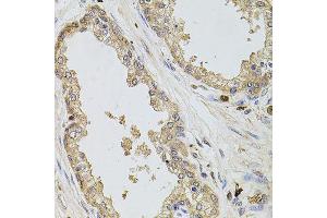 Immunohistochemistry of paraffin-embedded human prostate using KCNJ3 antibody (ABIN6003556) at dilution of 1/100 (40x lens). (KCNJ3 anticorps)