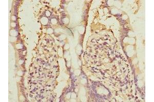 Immunohistochemistry of paraffin-embedded human small intestine tissue using ABIN7161944 at dilution of 1:100