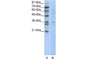WB Suggested Anti-CCNB3 Antibody Titration:  2. (Cyclin B3 anticorps  (N-Term))