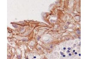 Image no. 1 for anti-Desmoglein 3 (DSG3) antibody (ABIN1721896) (Desmoglein 3 anticorps)
