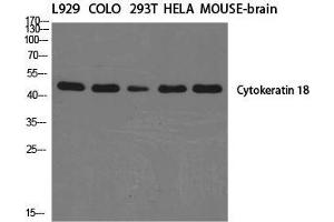 Western Blot (WB) analysis of specific cells using Cytokeratin 18 Polyclonal Antibody. (Cytokeratin 18 anticorps  (C-Term))