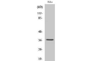 Western Blotting (WB) image for anti-Solute Carrier Family 25 (Mitochondrial Carrier, Adenine Nucleotide Translocator), Member 31 (SLC25A31) (Internal Region) antibody (ABIN3179873) (SLC25A31 anticorps  (Internal Region))