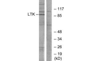 Western Blotting (WB) image for anti-Leukocyte Receptor tyrosine Kinase (LTK) (Internal Region) antibody (ABIN1849300) (LTK anticorps  (Internal Region))