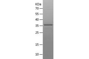 Western Blotting (WB) image for Clusterin (CLU) (AA 184-293) protein (His-IF2DI Tag) (ABIN7122411)