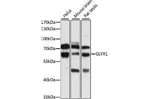 Western blot analysis of extracts of various cell lines, using GLYR1 antibody (ABIN6133101, ABIN6141170, ABIN6141171 and ABIN6224873) at 1:1000 dilution. (GLYR1 anticorps  (AA 70-270))