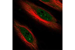 Immunofluorescent staining of human cell line HeLa with CDKN1C polyclonal antibody  at 1-4 ug/mL concentration shows positivity in nucleus but excluded from the nucleoli. (CDKN1C anticorps)