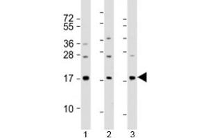 Western blot testing of human 1) A549, 2) HeLa and 3) spleen lysate with PLA2 antibody at 1:2000. (PLA2G1B anticorps  (AA 106-135))