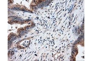 Image no. 2 for anti-Lipase, Endothelial (LIPG) antibody (ABIN1499163) (LIPG anticorps)