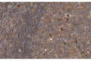 ABIN6266839 at 1/100 staining human lymph node tissue sections by IHC-P.