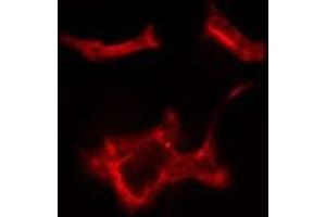 ABIN6279729 staining HeLa cells by IF/ICC. (RAB1B anticorps  (Internal Region))