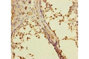 Immunohistochemistry of paraffin-embedded human testis tissue using ABIN7167274 at dilution of 1:100 (RAB27B anticorps  (AA 1-218))