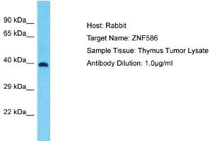 Host: Rabbit Target Name: ZNF586 Sample Type: Thymus Tumor lysates Antibody Dilution: 1. (ZNF586 anticorps  (Middle Region))